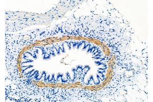 ABIN6260910 and ABIN6277858 at 1/100 staining Rat lung tissue by IHC-P. (Calponin 抗体  (N-Term))