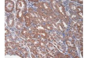 Immunohistochemistry (IHC) image for anti-Hepatitis A Virus Cellular Receptor 1 (HAVCR1) (AA 21-240) antibody (ABIN7426034)