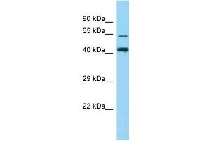 Western Blotting (WB) image for anti-Zinc Finger Protein 667 (ZNF667) (N-Term) antibody (ABIN2778606) (ZNF667 抗体  (N-Term))