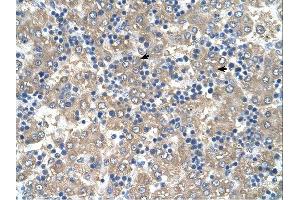 C3ORF10 antibody was used for immunohistochemistry at a concentration of 4-8 ug/ml. (BRK1 抗体  (Middle Region))