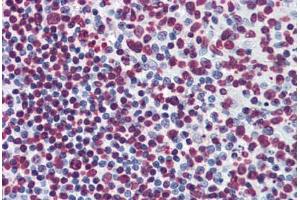 Human Tonsil: Formalin-Fixed, Paraffin-Embedded (FFPE) (BIK 抗体  (AA 37-136))