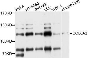 Western blot analysis of extract of various cells, using COL6A2 antibody. (COL6A2 抗体)