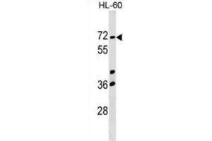 Western Blotting (WB) image for anti-Calicin (CCIN) antibody (ABIN2999591)