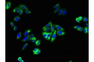 Immunofluorescent analysis of HepG2 cells using ABIN7172961 at dilution of 1:100 and Alexa Fluor 488-congugated AffiniPure Goat Anti-Rabbit IgG(H+L) (TMTC1 抗体  (AA 1-227))
