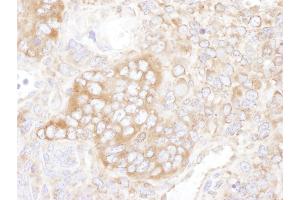 Immunohistochemistry (IHC) image for anti-Y Box Binding Protein 1 (YBX1) (AA 274-324) antibody (ABIN7454908)