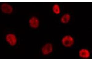 ABIN6275788 staining 293T by IF/ICC. (SUV39H2 抗体  (Internal Region))