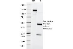 SDS-PAGE Analysis Purified Lewis Y Mouse Monoclonal Antibody (A70-A/A9). (Blood Group Lewis Y 抗体)