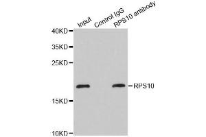 Immunoprecipitation analysis of 200ug extracts of MCF-7 cells using 1ug RPS10 antibody (ABIN1980247). (RPS10 抗体)