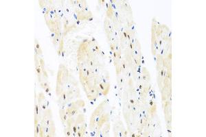 Immunohistochemistry of paraffin-embedded rat heart using TAF9 antibody (ABIN5971055) at dilution of 1/100 (40x lens). (TAF9 抗体)