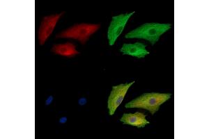 ABIN7095079 and ABIN7099135 staining  cells by IF/ICC. (KRIT1 抗体)