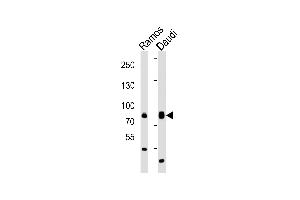 Western blot analysis of lysates from Ramos, Daudi cell line (from left to right), using TEC Antibody (Center) (ABIN6242484 and ABIN6577833). (NR4A3 抗体  (AA 254-288))