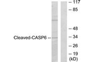 Western blot analysis of extracts from 293 cells, treated with Etoposide 25uM 60', using Caspase 6 (Cleaved-Asp162) Antibody. (Caspase 6 抗体  (Cleaved-Asp162))