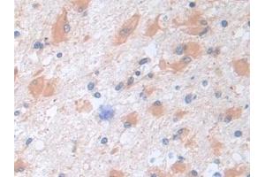 Detection of CAP3 in Human Cerebrum Tissue using Polyclonal Antibody to Cytoplasmic Antiproteinase 3 (CAP3)