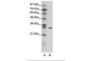 Image no. 1 for anti-NF-kappa-B inhibitor beta (NFKBIB) (AA 49-98) antibody (ABIN6736066) (NFKBIB 抗体  (AA 49-98))