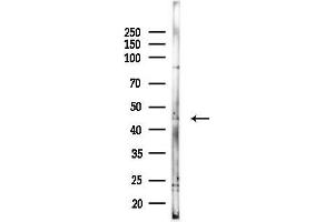 Western blot analysis of lysates from MCF7 cells(heat-shock,45 min treatment), using SERPINF1 Antibody at 1/1000 dilution.
