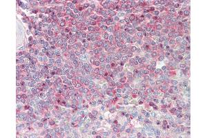 Anti-MSN / Moesin antibody IHC staining of human spleen. (Moesin 抗体  (AA 292-491))