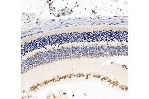 Immunohistochemistry (Paraffin-embedded Sections) (IHC (p)) image for anti-NAC alpha Domain Containing (NACAD) antibody (ABIN7074756)