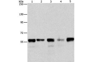 Western Blot analysis of Hela, Jurkat, 293T and K562 cell, Mouse testis tissue using ARIH2 Polyclonal Antibody at dilution of 1:550 (ARIH2 抗体)
