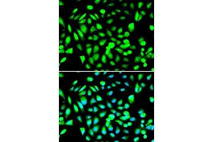 Immunofluorescence analysis of A549 cell using PRMT5 antibody. (PRMT5 抗体)