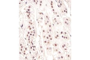 Immunohistochemistry (Paraffin-embedded Sections) (IHC (p)) image for anti-Parafibromin (CDC73) (AA 132-161) antibody (ABIN653128)