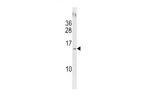 SD13 Antibody (C-term) (ABIN1881772 and ABIN2843204) western blot analysis in NCI- cell line lysates (35 μg/lane). (SAMD13 抗体  (C-Term))