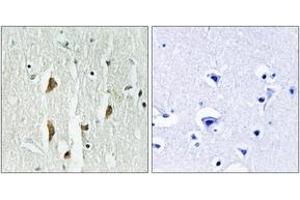 Immunohistochemistry analysis of paraffin-embedded human brain tissue, using PAK1/2/3 (Ab-423/402/421) Antibody. (PAK1/2/3 抗体  (AA 391-440))