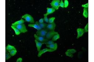 Immunofluorescence staining of HepG2 cells with ABIN7140126 at 1:168, counter-stained with DAPI. (STK4 抗体  (AA 6-24))