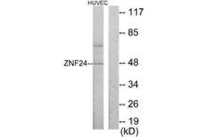 Western blot analysis of extracts from HuvEc cells, using ZNF24 Antibody. (ZNF24 抗体  (AA 10-59))