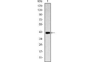 Western blot analysis using CD94 mAb against human CD94 (AA: 32-179) recombinant protein. (CD94 抗体)