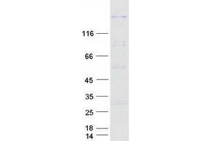 Western Blotting (WB) image for Sperm Specific Antigen 2 (SSFA2) (Transcript Variant 2) protein (Myc-DYKDDDDK Tag) (ABIN2732697)
