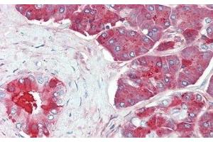 Immunohistochemistry (IHC) image for anti-Carboxypeptidase B1 (Tissue) (CPB1) (AA 111-417) antibody (ABIN7441961)