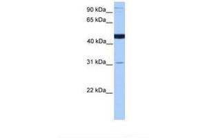 Image no. 1 for anti-Saccharopine Dehydrogenase (SCCPDH) (AA 316-365) antibody (ABIN6738887) (SCCPDH 抗体  (AA 316-365))