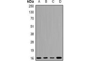Western blot analysis of UBCH7 expression in A549 (A), K562 (B), mouse testis (C), mouse brain (D) whole cell lysates. (UBE2L3 抗体)