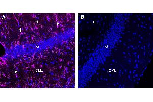 Comparison of immunostaining with Anti-GFAP antibody to immunostaining with isotype control in rat hippocampusImmunohistochemical staining of perfusion-fixed frozen rat brain sections with Anti-GFAP-ATTO Fluor-647N Antibody (ABIN7582030), (1:80). (兔 IgG isotype control (Atto 647N))