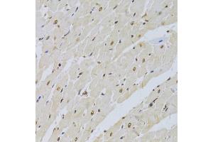 Immunohistochemistry of paraffin-embedded rat heart using SNRPA Antibody (ABIN5973811) at dilution of 1/100 (40x lens). (SNRPA1 抗体)