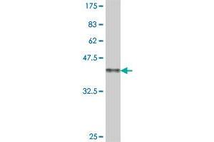 Western Blot detection against Immunogen (38. (GRK4 抗体  (AA 36-145))