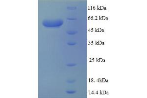 SDS-PAGE (SDS) image for ATP-Binding Cassette, Sub-Family B (MDR/TAP), Member 4 (ABCB4) (AA 352-708), (Cytoplasmic Domain), (Cytosolic) protein (GST tag) (ABIN5708985)