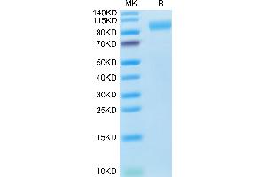 SDS-PAGE (SDS) image for Angiotensin I Converting Enzyme 2 (ACE2) (AA 18-740) protein (His tag) (ABIN7273791)