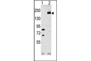 Image no. 1 for anti-Low Density Lipoprotein Receptor-Related Protein 6 (LRP6) (C-Term) antibody (ABIN358636) (LRP6 抗体  (C-Term))