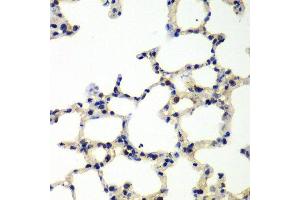 Immunohistochemistry of paraffin-embedded rat lung using PNKP antibody.