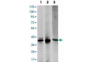Western blot analysis using MAP2K6 monoclonal antibody, clone 3H12C8  against HepG2 (1), MCF-7 (2) and NIH/3T3 (3) cell lysate.