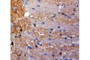 Used in DAB staining on fromalin fixed paraffin-embedded Brain tissue (SCGB3A1 抗体  (AA 21-104))