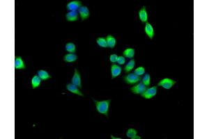 Immunofluorescence staining of PC-3 cells with ABIN7143044 at 1:166,counter-stained with DAPI. (ABLIM3 抗体  (AA 266-544))