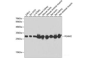 Western blot analysis of extracts of various cell lines using PGAM2 Polyclonal Antibody at dilution of 1:1000. (PGAM2 抗体)