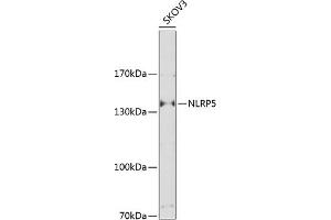 Western blot analysis of extracts of SKOV3 cells, using NLRP5 Antibody (ABIN6131482, ABIN6144667, ABIN6144668 and ABIN6225229) at 1:1000 dilution.