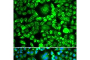 Immunofluorescence analysis of MCF-7 cells using BLID Polyclonal Antibody (BLID 抗体)