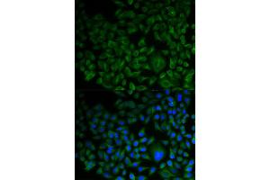 Immunofluorescence (IF) image for anti-Farnesyl-Diphosphate Farnesyltransferase 1 (FDFT1) antibody (ABIN1882356) (FDFT1 抗体)