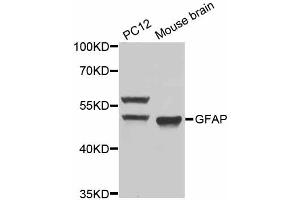 Western blot analysis of extracts of various cell lines, using GFAP antibody (ABIN5970067) at 1/1000 dilution. (GFAP 抗体)