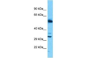 Host:  Rabbit  Target Name:  SLC25A30  Sample Type:  Uterus Tumor lysates  Antibody Dilution:  1. (SLC25A30 抗体  (N-Term))