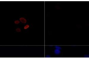 Immunofluorescence analysis of C6 cells treated by TSA (upper left) and untreated C6 cells (upper right) using Acetyl-Histone H4-K16 Polyclonal Antibody at dilution of 1:100. (Histone H4 抗体  (acLys16))